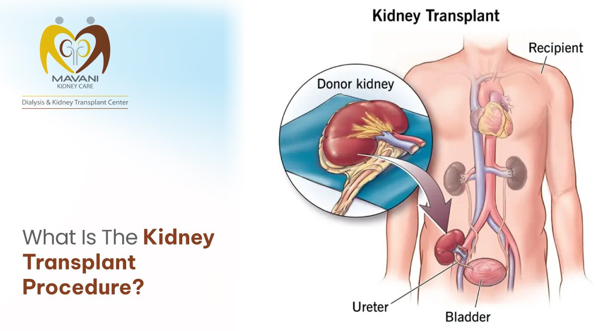 Urine Color of Kidney Failure